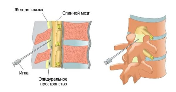 a kenőcsök segítik-e a nyaki osteochondrozist)
